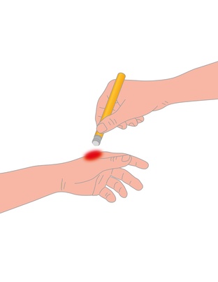 AFTER BITE ΓΙΑ ΜΕΤΑ ΤΟ ΤΣΙΜΠΗΜΑ ΣΤΙΚ 16ml